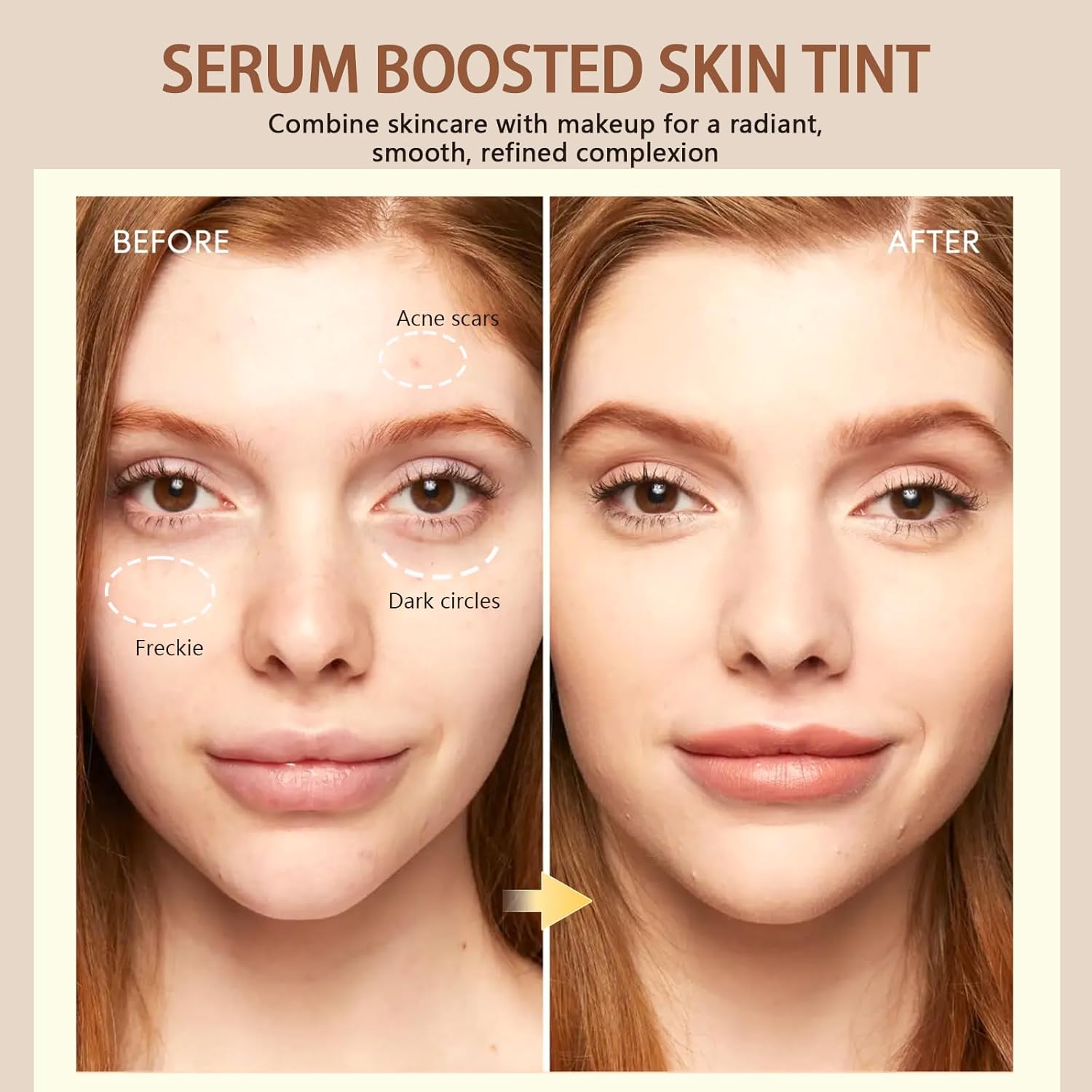 Vorher-Nachher-Bild des Serum Boosted Skin Tint für einen radianten, glatten Teint.