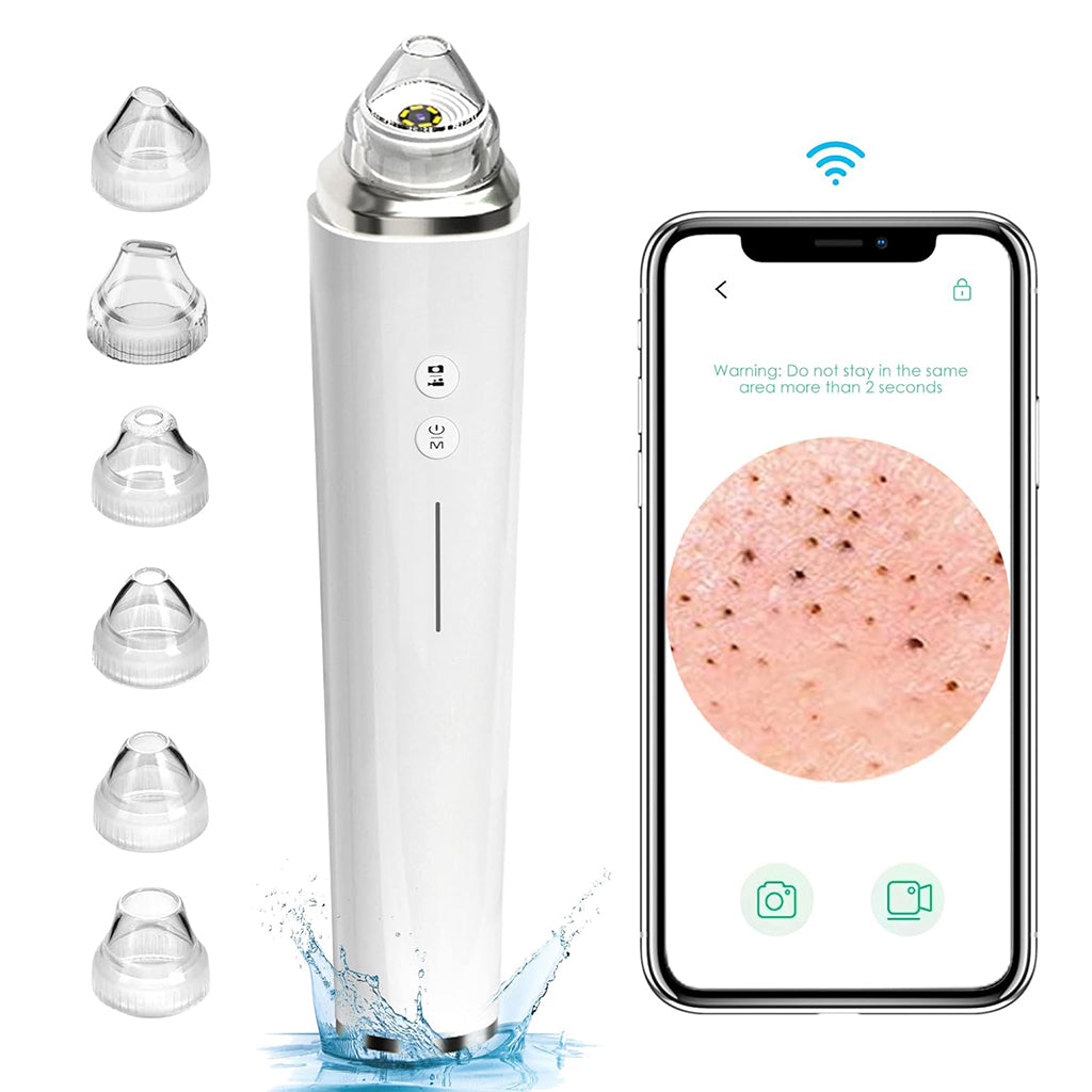 Glinterra – Professioneller Porenreiniger mit Kamera, HD-Kamera zum Entfernen von Mitessern und Hautunreinheiten.